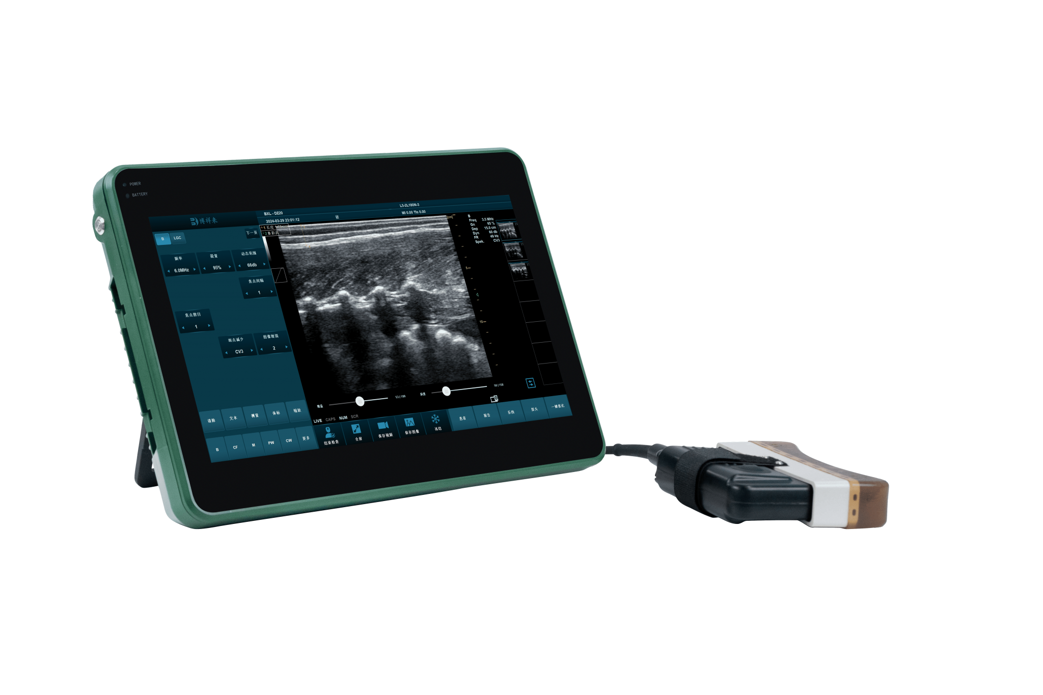 Bxl S100 Wireless Veterinary Ultrasound