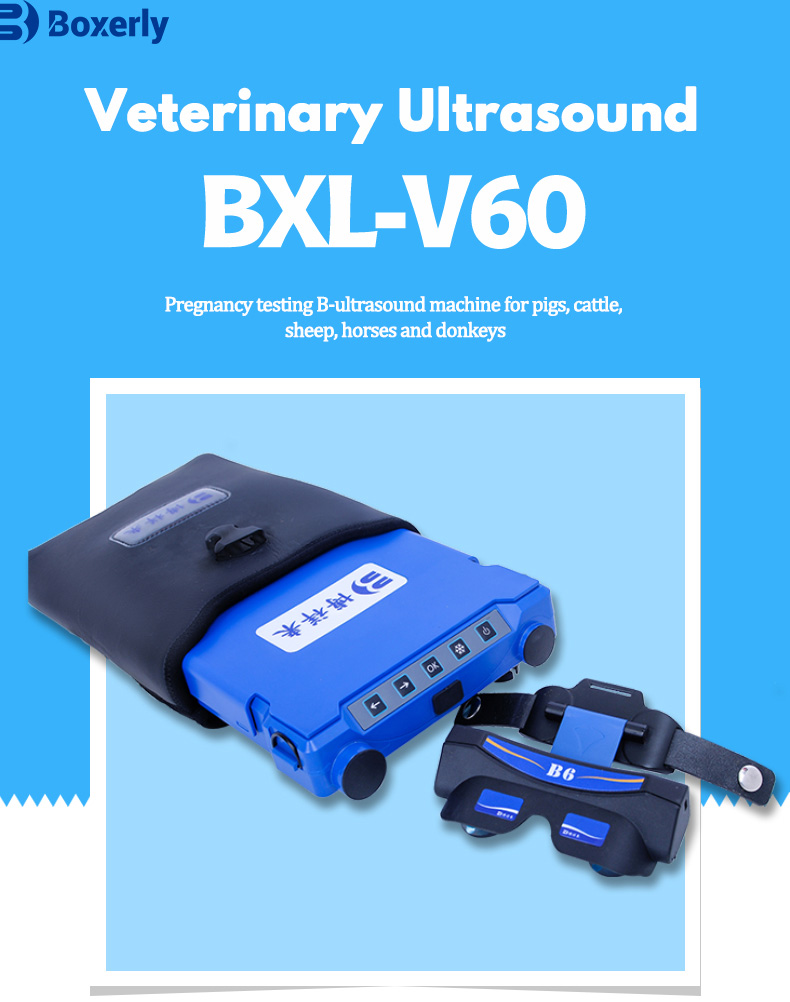 BXL-V60 Portable Ultrasound Machine(图1)