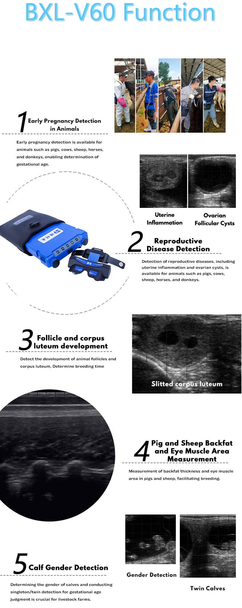 BXL-V60 Portable Ultrasound Machine(图6)