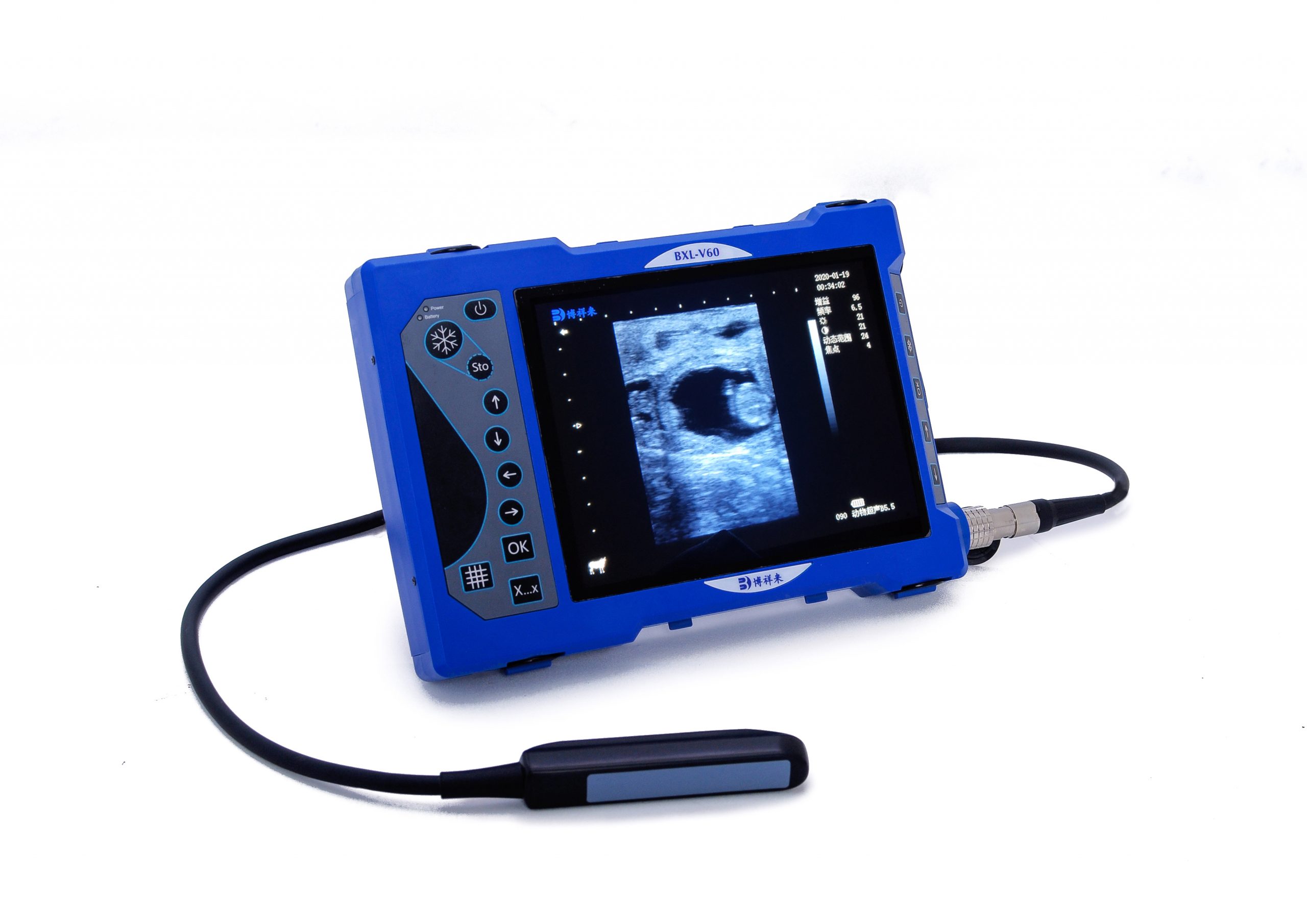 Portable Bovine Ultrasound Machine BXL-V60: A Game-Changer for Cattle Health Management