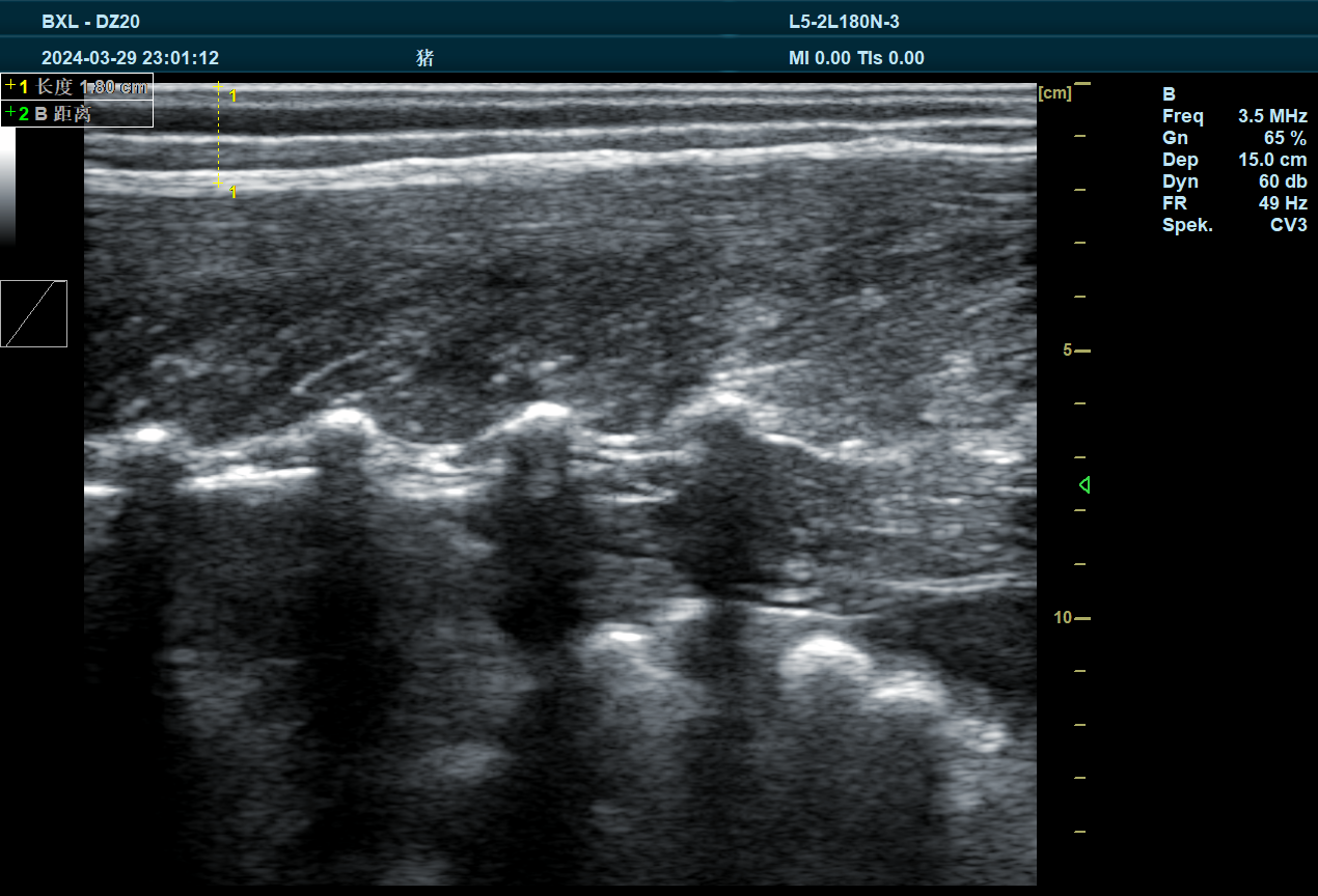 What are the characteristics of breast hyperplasia in dairy cows detected by veterinary B-ultrasound