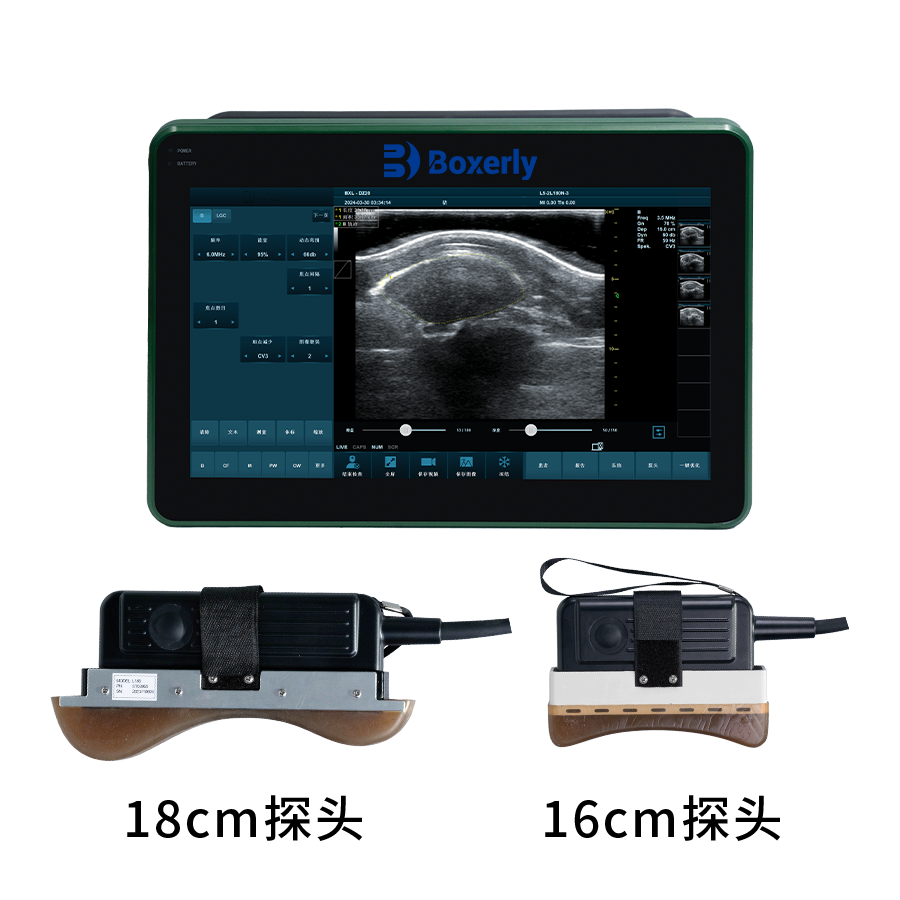 What are the characteristics of breast hyperplasia in dairy cows detected by veterinary B-ultrasound machine?(图1)