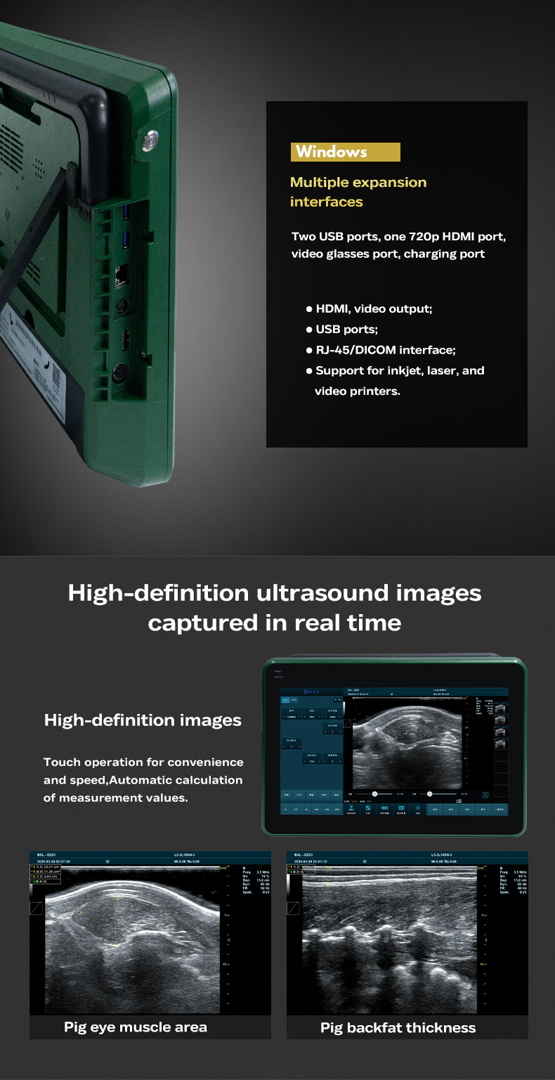 BXL-DZ20 Veterinary Color Doppler Ultrasound Diagnostic Instrument(图4)