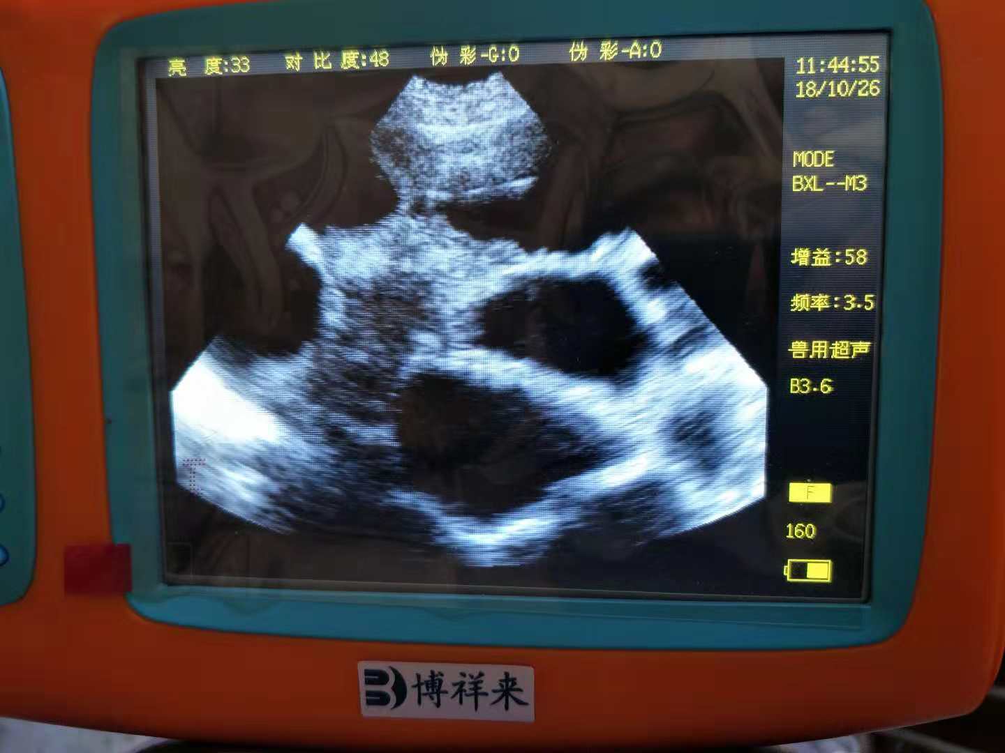 Design of veterinary B-ultrasound machine hardware and software and system improvement(图1)