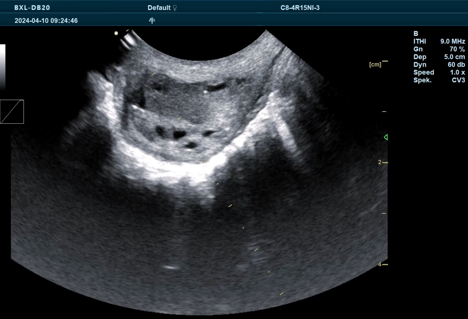 Diagnosis of different types of uterine pyometra in female dogs using veterinary B-ultrasound