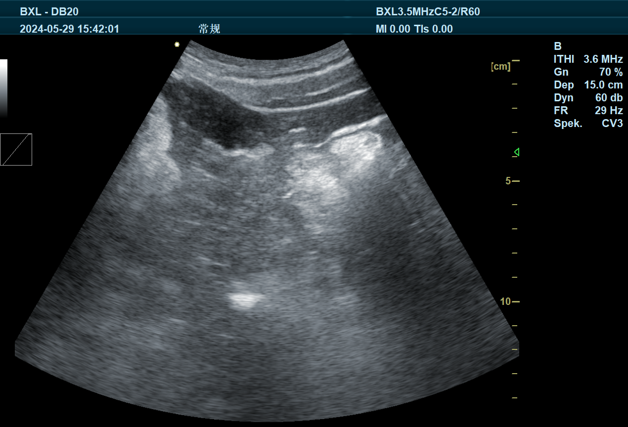 B-ultrasound examination of postpartum exudative metritis in dairy cows(图2)