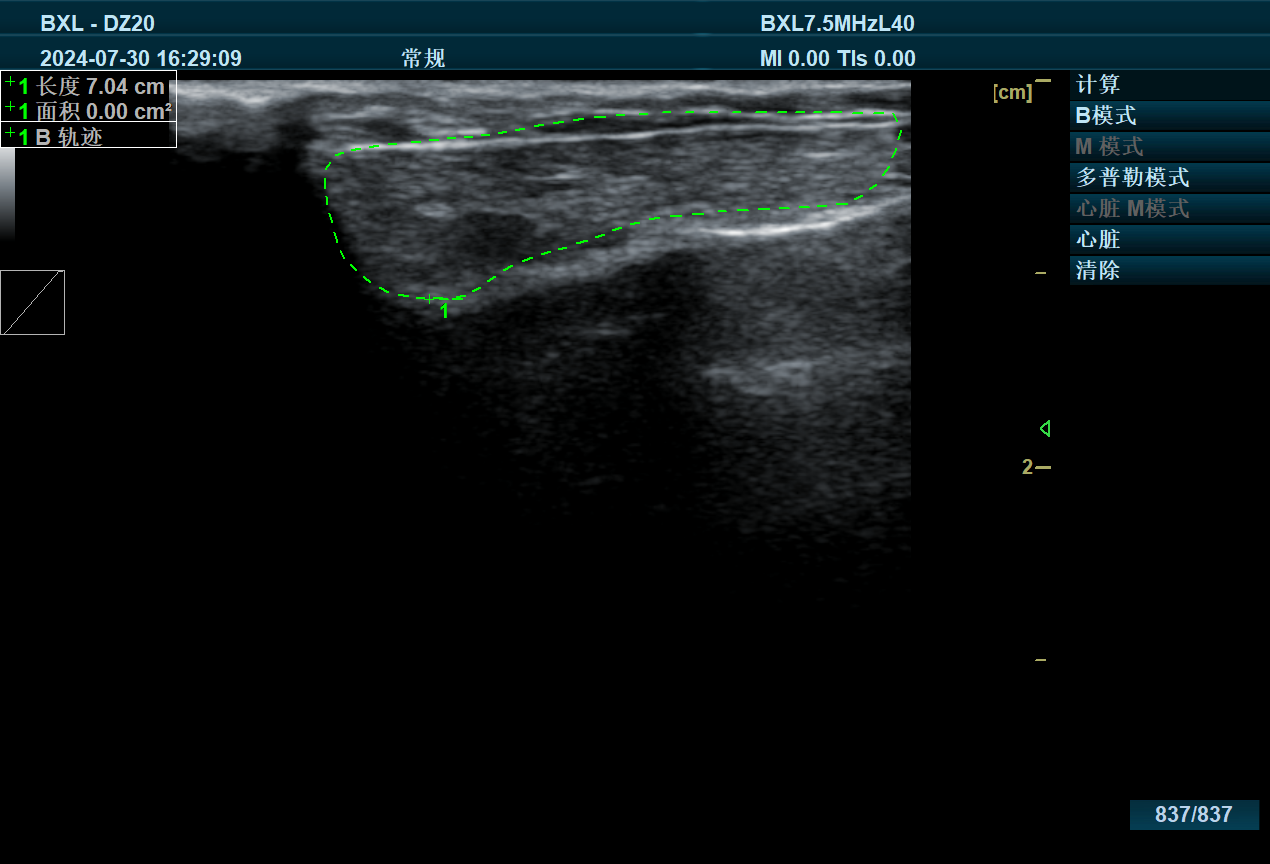 How does veterinary B-ultrasound help female dog breeders?(图1)