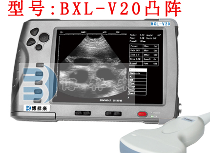 Animal B ultrasound image of intraductal mammary papilloma