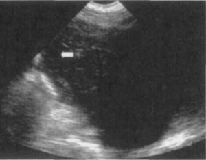 Detailed picture and text explanation of the usage of the B-ultrasound machine for pigs(图5)