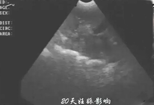 Detailed picture and text explanation of the usage of the B-ultrasound machine for pigs(图6)