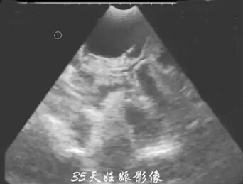 Detailed picture and text explanation of the usage of the B-ultrasound machine for pigs(图16)