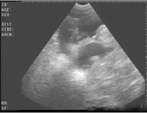 Detailed picture and text explanation of the usage of the B-ultrasound machine for pigs(图9)