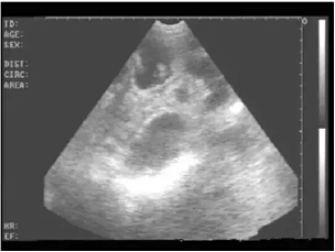 Detailed picture and text explanation of the usage of the B-ultrasound machine for pigs(图10)