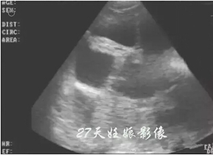 Detailed picture and text explanation of the usage of the B-ultrasound machine for pigs(图13)