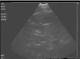 Detailed picture and text explanation of the usage of the B-ultrasound machine for pigs(图22)