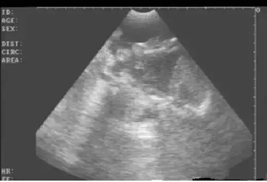 Detailed picture and text explanation of the usage of the B-ultrasound machine for pigs(图26)