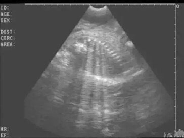 Detailed picture and text explanation of the usage of the B-ultrasound machine for pigs(图27)