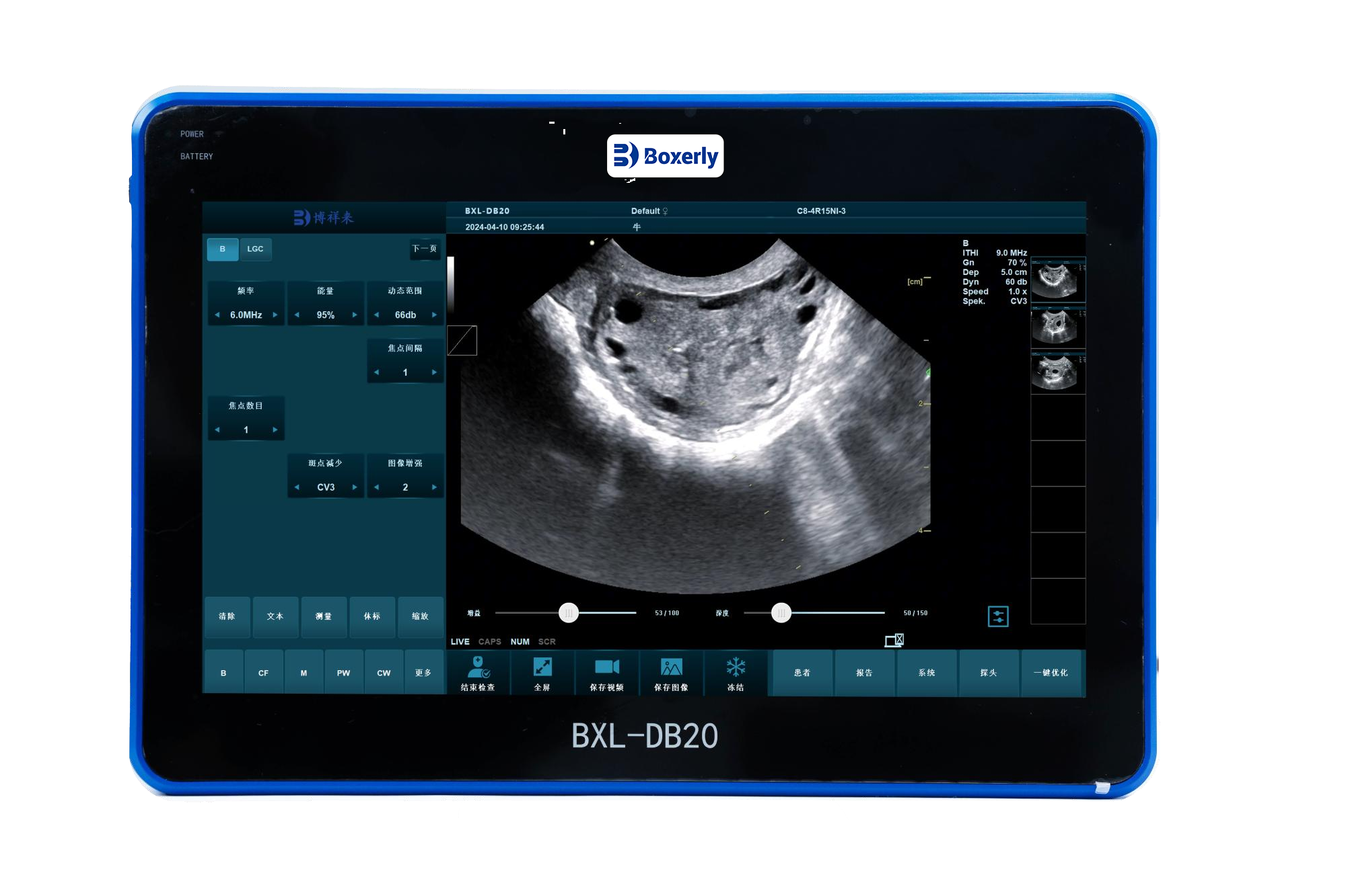 Necessity of using B-ultrasound to detect ovulation in calves(图1)