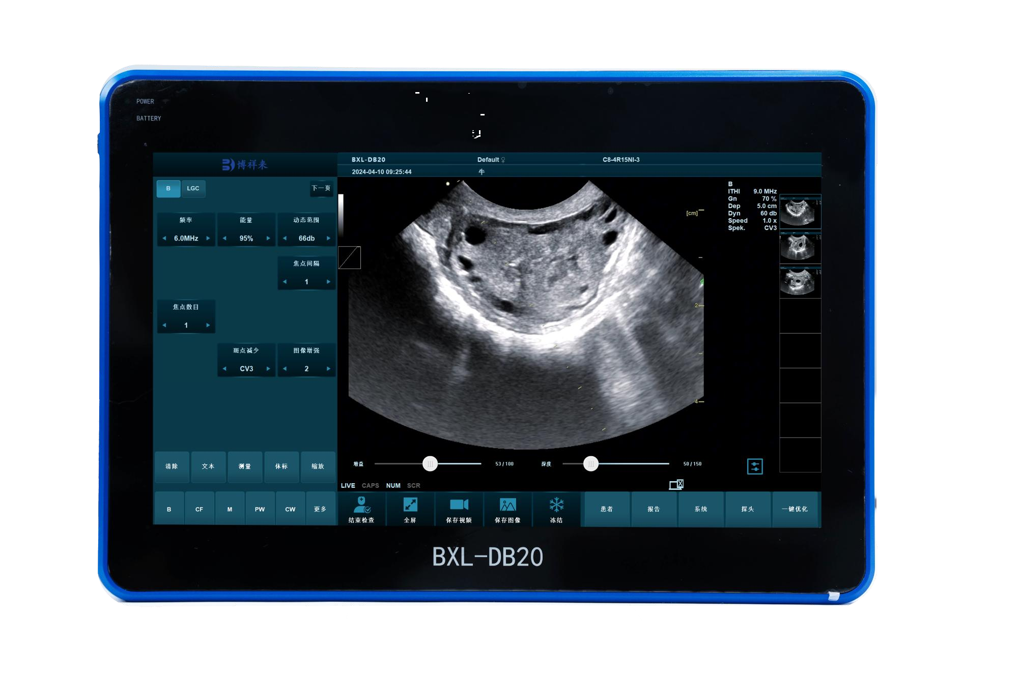 The difference between B-ultrasound for cattle and A-ultrasound for veterinary examination(图1)