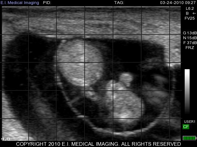 Using B-ultrasound to observe the development of follicles and corpus luteum after delivery in cows