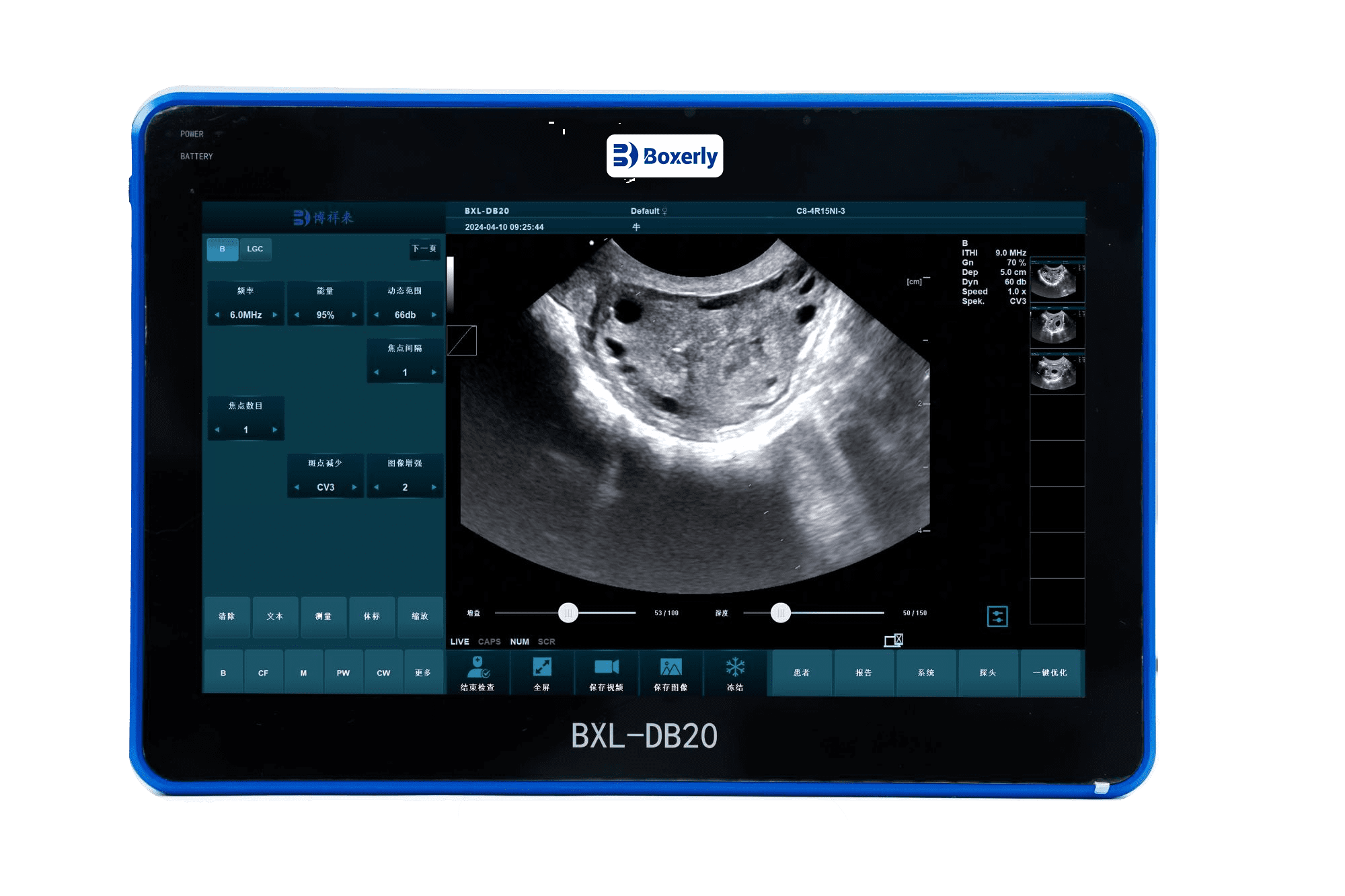 Problems and solutions in the operation of B-ultrasound machine for cattle