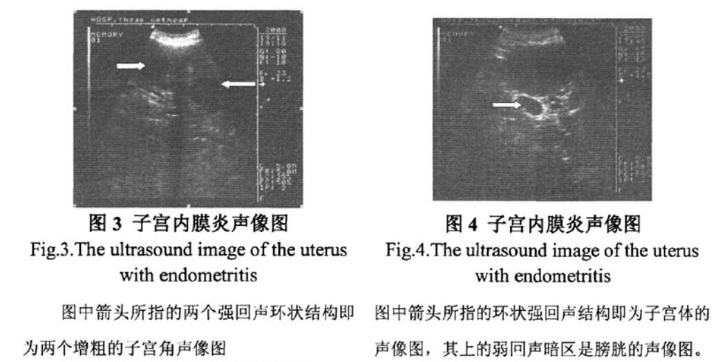 Characteristics of endometritis in dogs detected by veterinary B-ultrasound