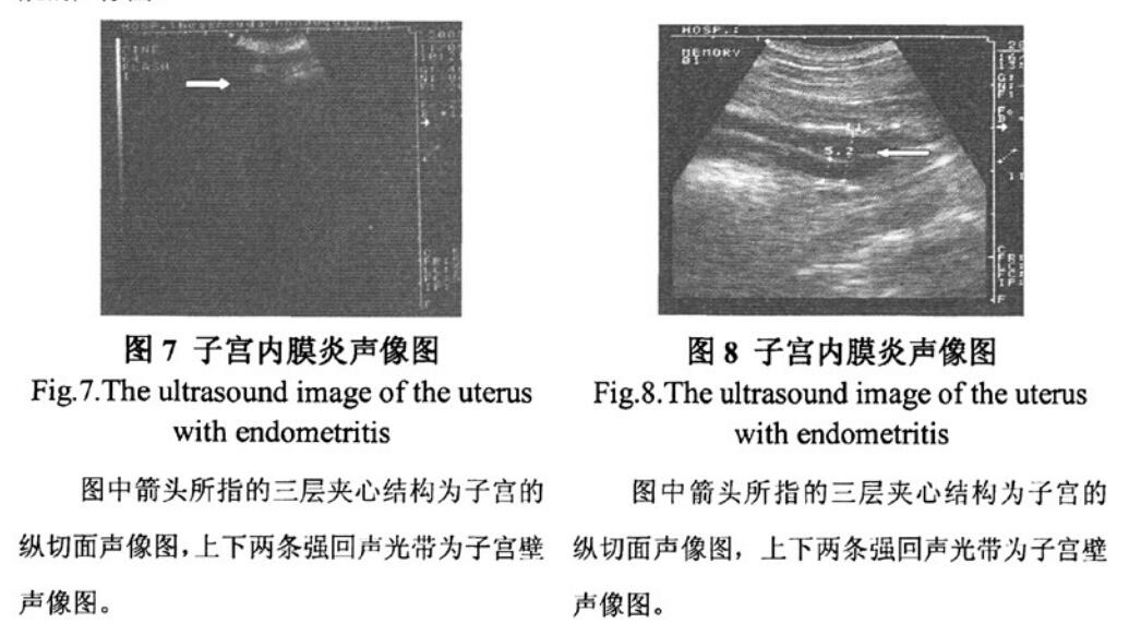 Characteristics of endometritis in dogs detected by veterinary B-ultrasound(图3)