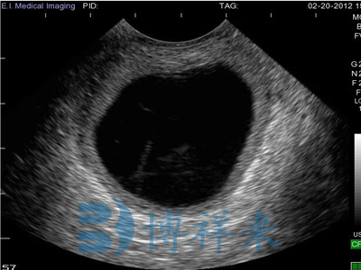 Observation of the difference between bovine follicles and corpus luteum cysts using B-ultrasound machine in cows(图5)