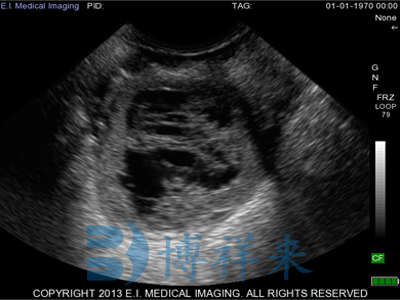 Observation of the difference between bovine follicles and corpus luteum cysts using B-ultrasound machine in cows(图6)