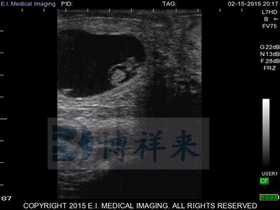 How to deal with non pregnant cows detected by animal B-ultrasound machine