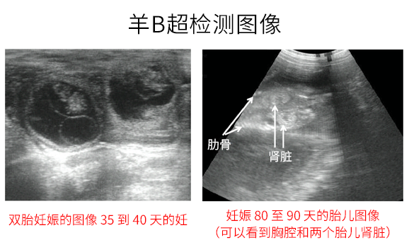 Ultrasound pregnancy detection of sheep using B-ultrasound machine(图1)