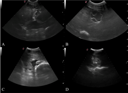 Detection of sheep liver using B-ultrasound machine(图2)