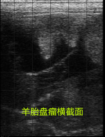 Ultrasound pregnancy detection of sheep using animal B-ultrasound BXL-V50(图3)