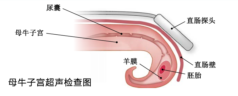 Schematic diagram of using B-ultrasound machine probe to detect cows(图1)