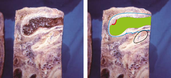 Schematic diagram of using B-ultrasound machine probe to detect cows(图2)