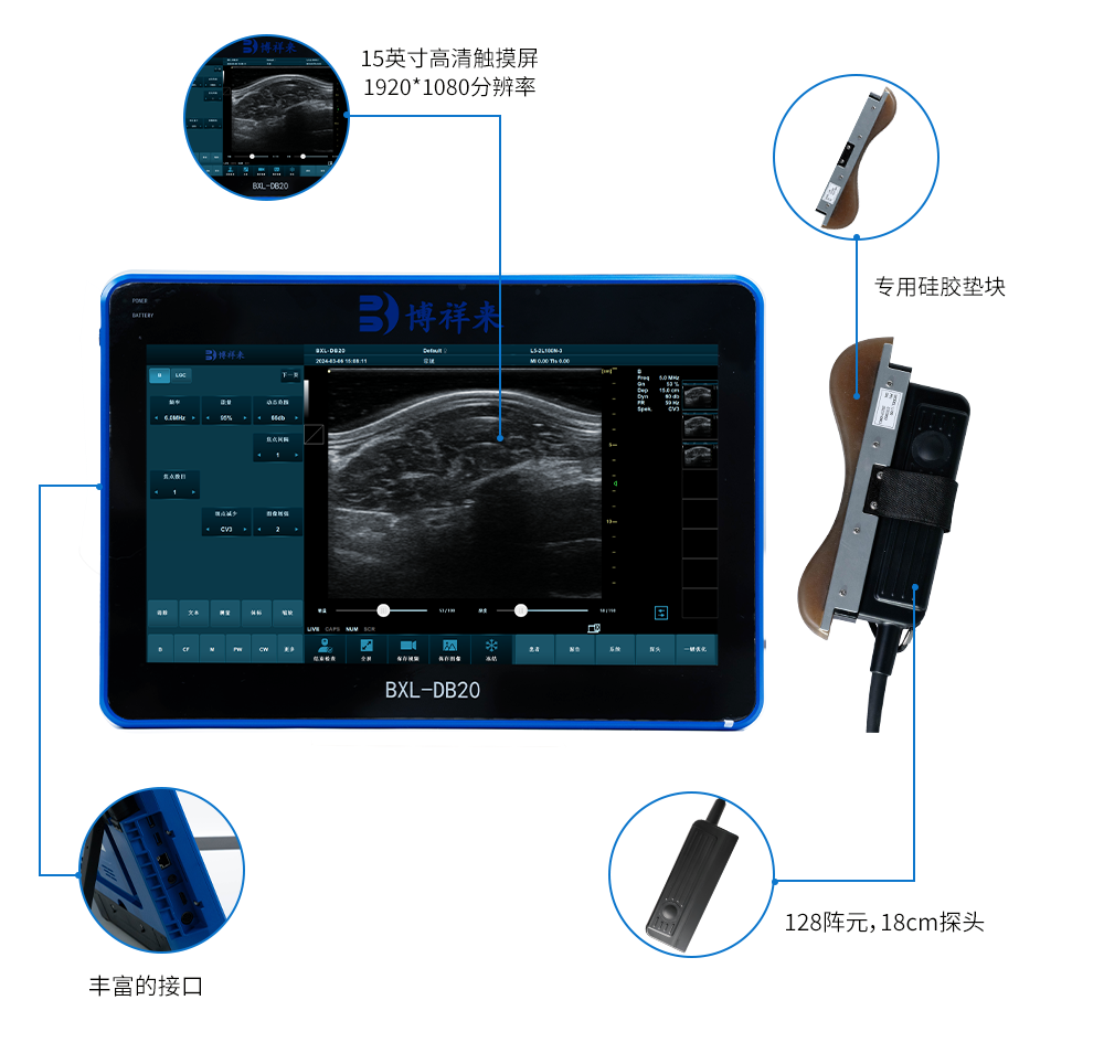 The price and selection of domestic cattle backfat eye muscle tester(图1)