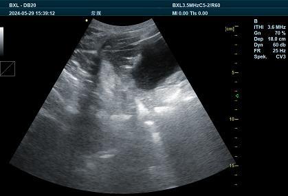 BXL Sound Veterinary Ultrasound: Revolutionizing Animal Care with Advanced Diagnostic Imaging