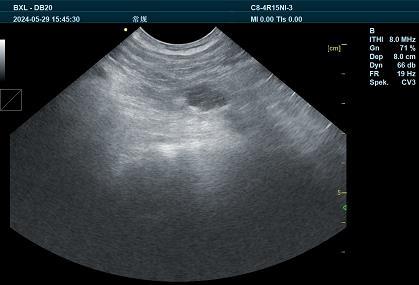 Using B-ultrasound diagnostic technology to solve infertility in cows