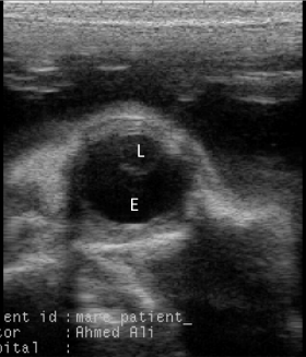 Precautions for detecting late pregnancy in horses using veterinary ultrasound machines(图2)