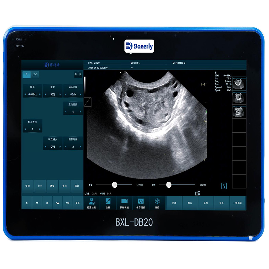 Large Animal Ultrasound Machines: A Vital Tool for Veterinary Care and Farm Management(图1)