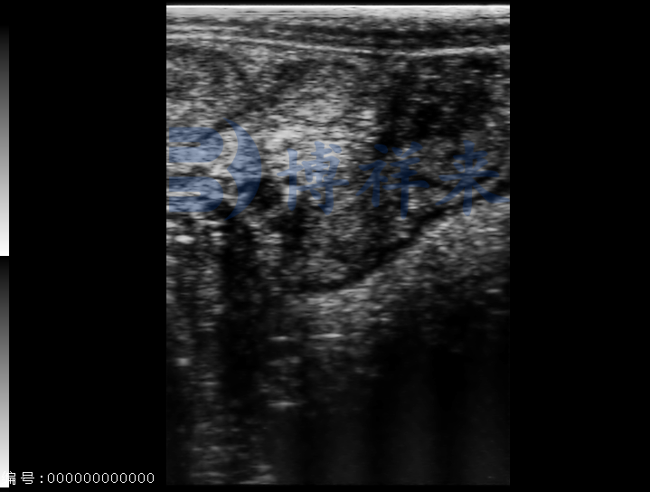 Small Animal: Radiography Vs Ultrasound Part