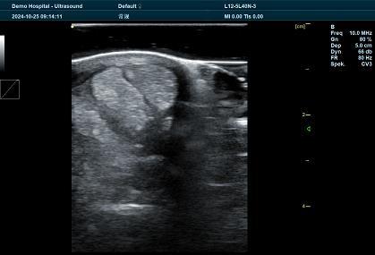 Veterinary Ultrasound BXL Horse Tendon Testing: A Revolutionary Tool for Equine Health