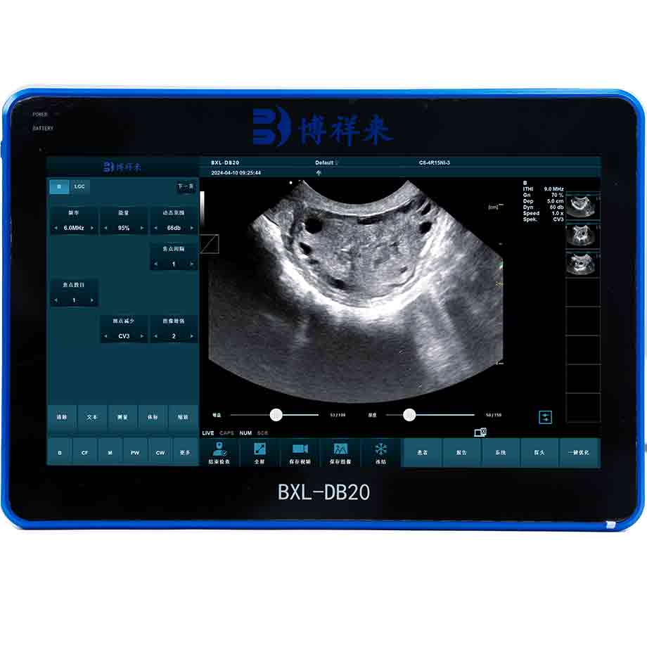 Price of Veterinary Ultrasound Instruments for Horse Tendons