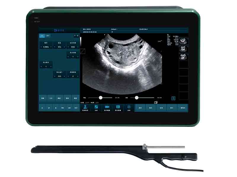 BXL Oocyte Pick-Up (OPU) Ultrasound Machine's Impact on New Variety Breeding