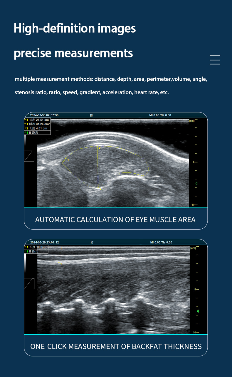 Veterinary back fat eye muscle measuring instrument BXL-DZ20(图3)