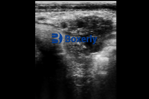 Early Detection of Uterine Infections in Cattle with Ultrasound(图3)