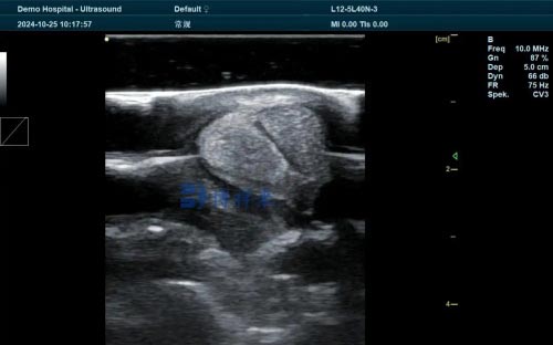 Diagnostic Performance of Ultrasound in Detecting Soft Tissue Injuries in Sport Horse Limbs(图2)