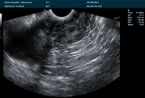 Sheep Reproduction with an Ultrasound System(图3)