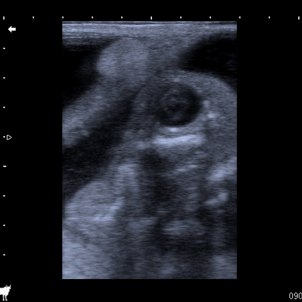 Late-term embryo (head)