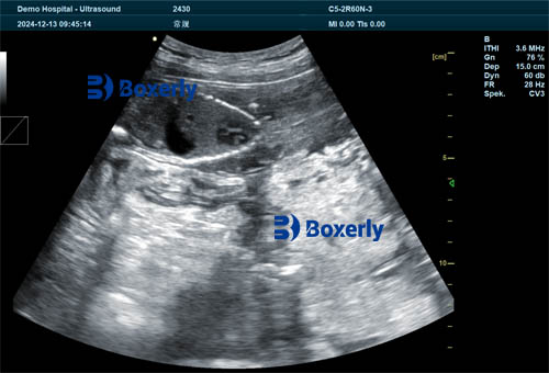 Assessing Field Portable Ultrasound in Animal Reproductive Monitoring